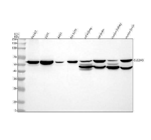 Anti-GLUT3 SLC2A3 Rabbit Monoclonal Antibody Boster Bio