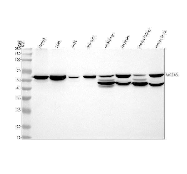 Anti-GLUT3 SLC2A3 Rabbit Monoclonal Antibody Boster Bio