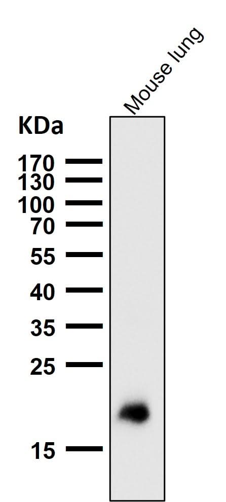 Anti-Claudin 5 CLDN5 Rabbit Monoclonal Antibody Boster Bio