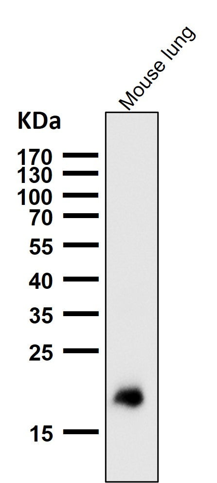 Anti-Claudin 5 CLDN5 Rabbit Monoclonal Antibody Boster Bio