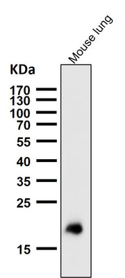 Anti-Claudin 5 CLDN5 Rabbit Monoclonal Antibody Boster Bio