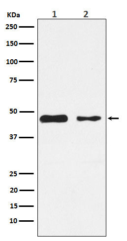 Anti-PDK2 Monoclonal Antibody Boster Bio
