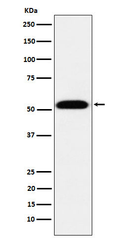 Anti-TEAD1 Rabbit Monoclonal Antibody Boster Bio