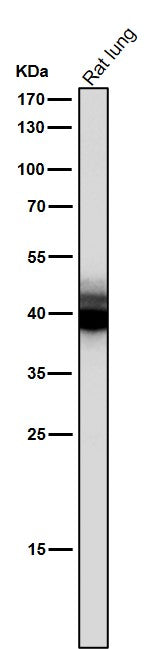 Anti-Mesothelin Monoclonal Antibody Boster Bio