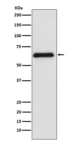 Anti-PARP2 Rabbit Monoclonal Antibody Boster Bio