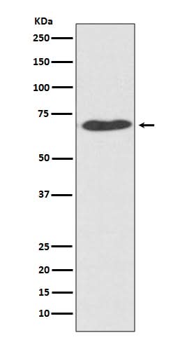 Anti-PDI PDIA2 Rabbit Monoclonal Antibody Boster Bio