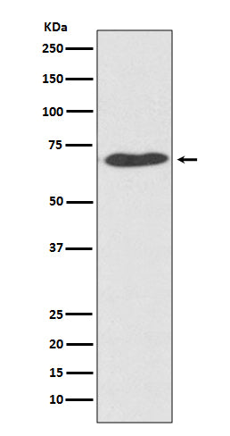 Anti-PDI PDIA2 Rabbit Monoclonal Antibody Boster Bio