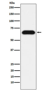 Anti-Nucleostemin Rabbit Monoclonal Antibody Boster Bio
