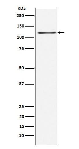 Anti-KSR1 Rabbit Monoclonal Antibody Boster Bio