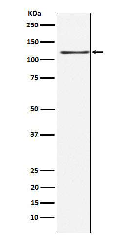 Anti-KSR1 Rabbit Monoclonal Antibody Boster Bio