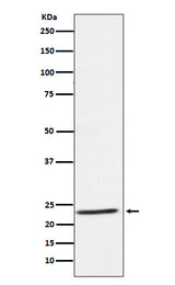 Anti-IL32 Rabbit Monoclonal Antibody Boster Bio