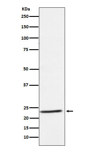 Anti-IL32 Rabbit Monoclonal Antibody Boster Bio