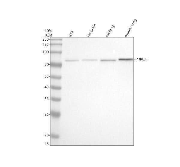 Anti-PKC eta Rabbit Monoclonal Antibody Boster Bio