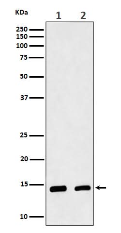 Anti-CRABP2 Rabbit Monoclonal Antibody Boster Bio