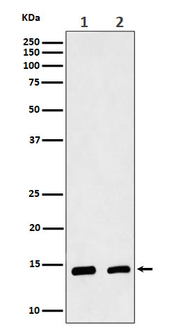 Anti-CRABP2 Rabbit Monoclonal Antibody Boster Bio