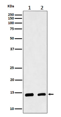 Anti-CRABP2 Rabbit Monoclonal Antibody Boster Bio