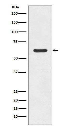 Anti-ASNS/Asparagine Synthetase Rabbit Monoclonal Antibody Boster Bio