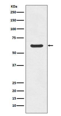 Anti-ASNS/Asparagine Synthetase Rabbit Monoclonal Antibody Boster Bio
