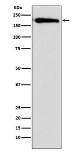 Anti-SMARCC1/BAF155 Rabbit Monoclonal Antibody Boster Bio