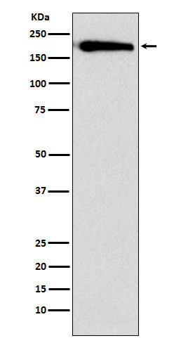 Anti-SMARCC1/BAF155 Rabbit Monoclonal Antibody Boster Bio
