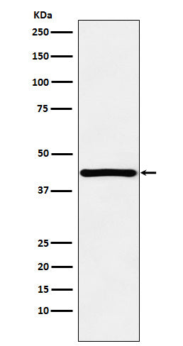 Anti-HOXA13 Rabbit Monoclonal Antibody Boster Bio
