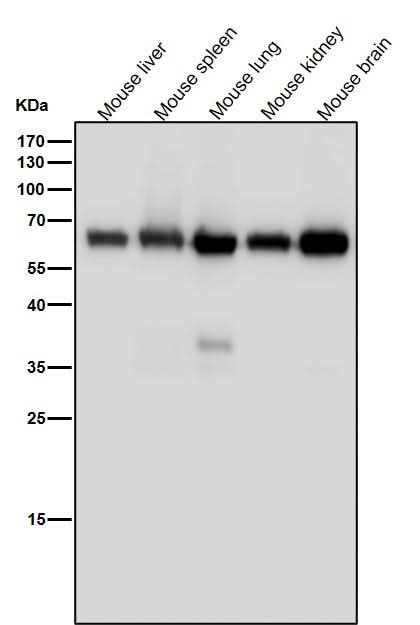 Anti-Monoamine Oxidase A Rabbit Monoclonal Antibody Boster Bio