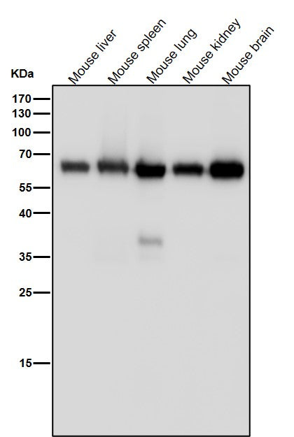 Anti-Monoamine Oxidase A Rabbit Monoclonal Antibody Boster Bio