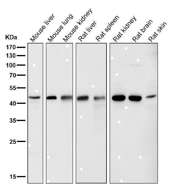 Anti-LXR alpha NR1H3 Rabbit Monoclonal Antibody Boster Bio