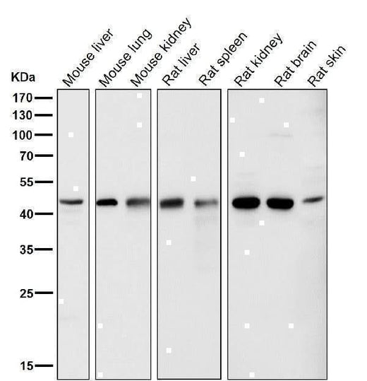 Anti-LXR alpha NR1H3 Rabbit Monoclonal Antibody Boster Bio