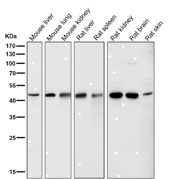 Anti-LXR alpha NR1H3 Rabbit Monoclonal Antibody Boster Bio