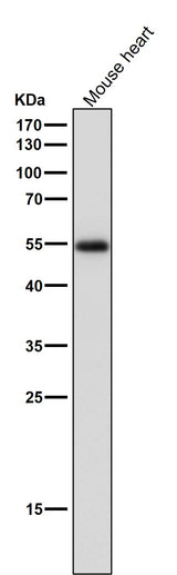 Anti-ERR alpha Rabbit Monoclonal Antibody Boster Bio