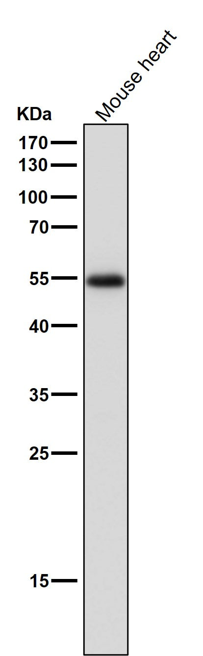 Anti-ERR alpha Rabbit Monoclonal Antibody Boster Bio