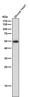 Anti-ERR alpha Rabbit Monoclonal Antibody Boster Bio