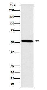Anti-Fukutin Rabbit Monoclonal Antibody Boster Bio