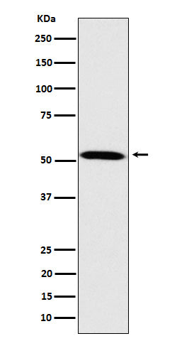 Anti-Fukutin Rabbit Monoclonal Antibody Boster Bio