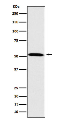 Anti-Fukutin Rabbit Monoclonal Antibody Boster Bio
