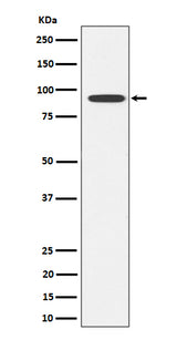 Anti-Glyt2 Rabbit Monoclonal Antibody Boster Bio