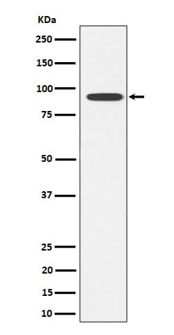 Anti-Glyt2 Rabbit Monoclonal Antibody Boster Bio