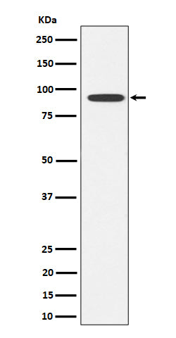 Anti-Glyt2 Rabbit Monoclonal Antibody Boster Bio