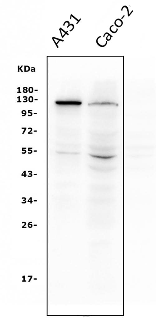 Anti-P-Cadherin-3 CDH3-Antibody Picoband® (monoclonal, 3C9 Boster Bio