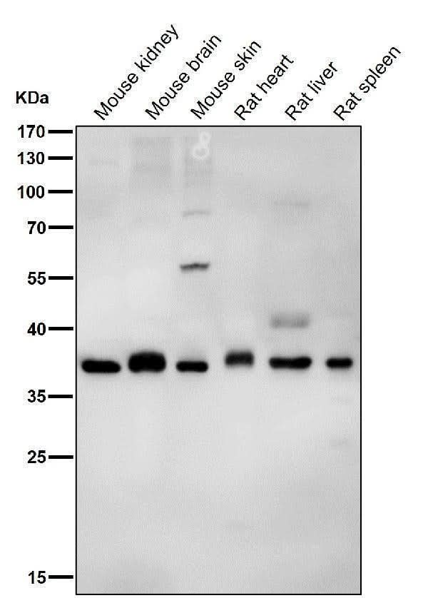 Anti-PAX9 Rabbit Monoclonal Antibody Boster Bio