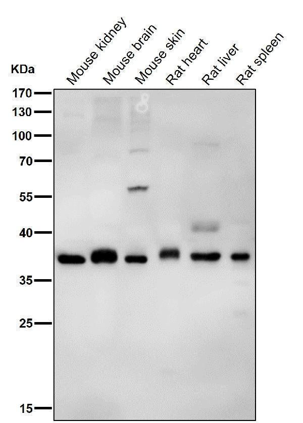 Anti-PAX9 Rabbit Monoclonal Antibody Boster Bio