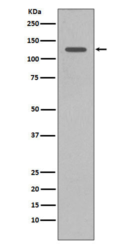 Anti-SHIP INPP5D Rabbit Monoclonal Antibody Boster Bio