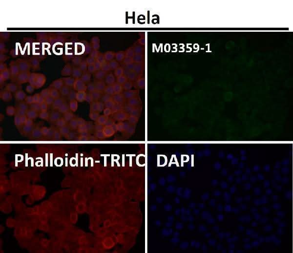 Anti-PODXL Monoclonal Antibody Boster Bio