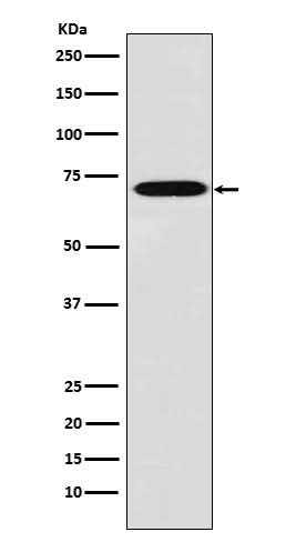 Anti-Plastin L Rabbit Monoclonal Antibody Boster Bio