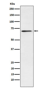 Anti-Plastin L Rabbit Monoclonal Antibody Boster Bio