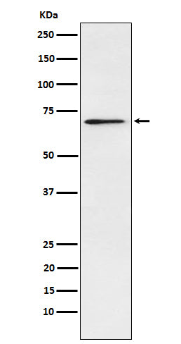 Anti-Plastin L Rabbit Monoclonal Antibody Boster Bio