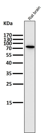 Anti-PI 3 Kinase p85 beta PIK3R2 Rabbit Monoclonal Antibody Boster Bio
