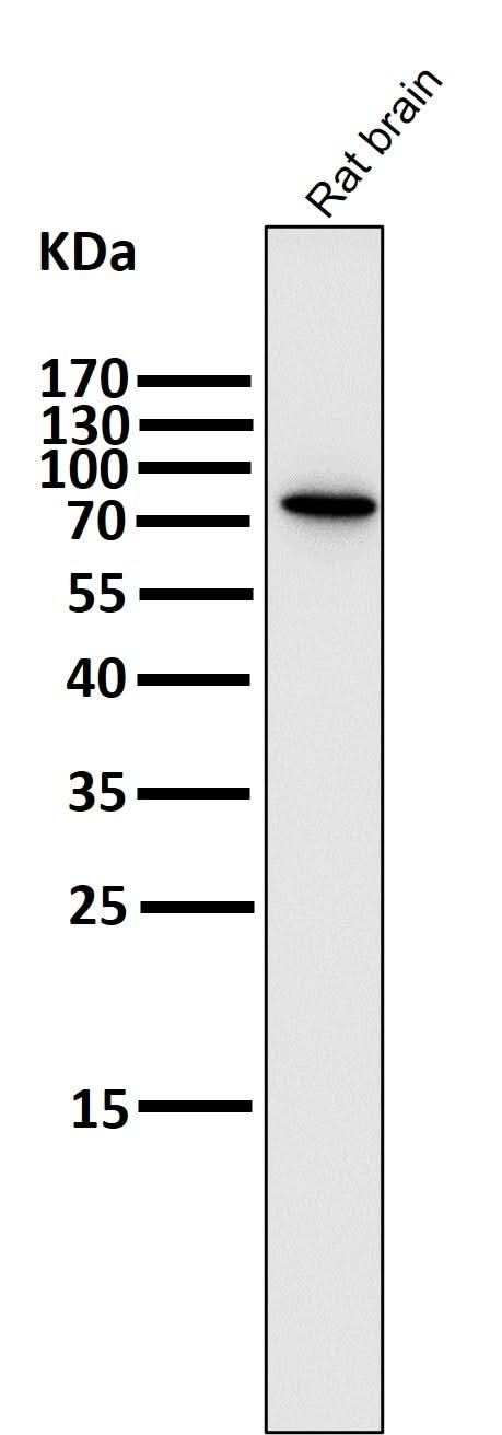 Anti-PI 3 Kinase p85 beta PIK3R2 Rabbit Monoclonal Antibody Boster Bio