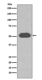 Anti-GC / VDBP Rabbit Monoclonal Antibody Boster Bio